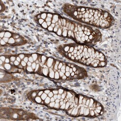 Invitrogen CCDC43 Polyclonal Antibody 100 &mu;L; Unconjugated:Antibodies,