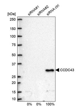 Invitrogen CCDC43 Polyclonal Antibody 100 &mu;L; Unconjugated:Antibodies,