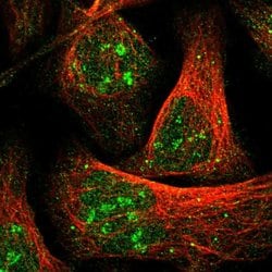 Invitrogen ZBTB37 Polyclonal Antibody 100 &mu;L; Unconjugated:Antibodies,