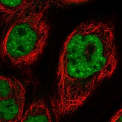 Invitrogen DDX42 Polyclonal Antibody 100 &mu;L; Unconjugated:Antibodies,