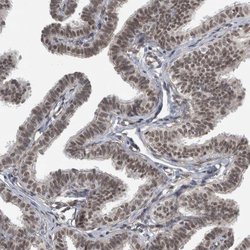 Invitrogen DDX42 Polyclonal Antibody 100 &mu;L; Unconjugated:Antibodies,