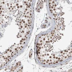 Invitrogen DDX42 Polyclonal Antibody 100 &mu;L; Unconjugated:Antibodies,