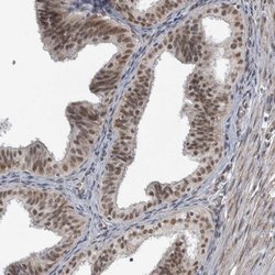 Invitrogen DDX42 Polyclonal Antibody 100 &mu;L; Unconjugated:Antibodies,