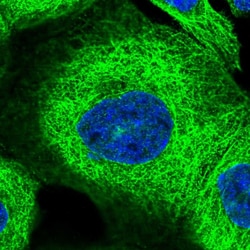 Invitrogen ZNF347 Polyclonal Antibody 100 &mu;L | Buy Online | Invitrogen&trade; | Fisher Scientific