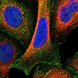 Invitrogen MGC87631 Polyclonal Antibody 100 &mu;L; Unconjugated:Antibodies,
