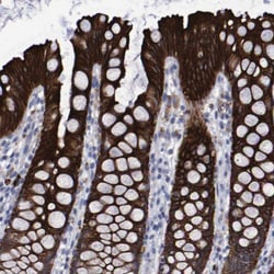 Invitrogen MGC87631 Polyclonal Antibody 100 &mu;L; Unconjugated:Antibodies,