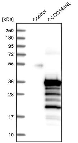 Invitrogen MGC87631 Polyclonal Antibody 100 &mu;L; Unconjugated:Antibodies,
