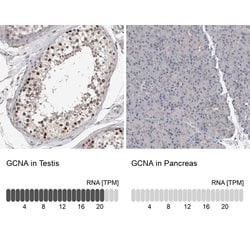 Invitrogen ACRC Polyclonal Antibody 100 &mu;L; Unconjugated:Antibodies,