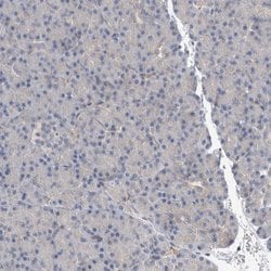 Invitrogen ACRC Polyclonal Antibody 100 &mu;L; Unconjugated:Antibodies,