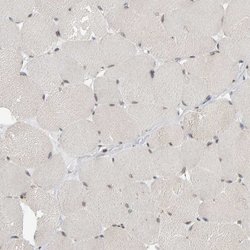 ATF7IP Polyclonal Antibody, Invitrogen 100 &mu;L | Buy Online | Invitrogen | Fisher Scientific