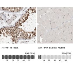 ATF7IP Polyclonal Antibody, Invitrogen 100 &mu;L | Buy Online | Invitrogen | Fisher Scientific