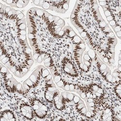 Invitrogen SON Polyclonal Antibody 100 &mu;L; Unconjugated:Antibodies,