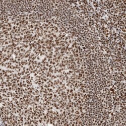 Invitrogen SON Polyclonal Antibody 100 &mu;L; Unconjugated:Antibodies,