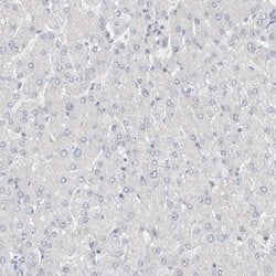Invitrogen DUOX1 Polyclonal Antibody 100 &mu;L | Buy Online | Invitrogen&trade; | Fisher Scientific