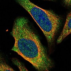 Invitrogen CtBP2 Polyclonal Antibody 100 &mu;L; Unconjugated:Antibodies,