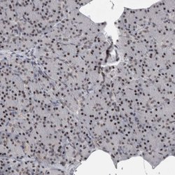 Invitrogen DDX42 Polyclonal Antibody 100 &mu;L; Unconjugated:Antibodies,