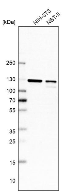 Invitrogen DDX42 Polyclonal Antibody 100 &mu;L; Unconjugated:Antibodies,