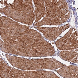Invitrogen PHF21A Polyclonal Antibody 100 &mu;L; Unconjugated:Antibodies,