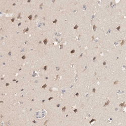 C17orf97 Polyclonal Antibody:Antibodies, Polyclonal