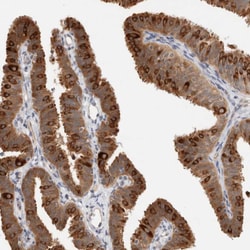 C17orf97 Polyclonal Antibody:Antibodies, Polyclonal