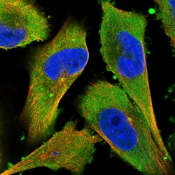 Invitrogen LONRF1 Polyclonal Antibody 100 &mu;L; Unconjugated:Antibodies,