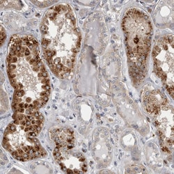 Invitrogen CTBS Polyclonal Antibody 100 &mu;L; Unconjugated:Antibodies,