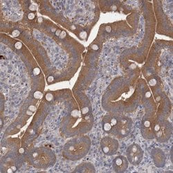CTBS Polyclonal Antibody, Invitrogen&trade;