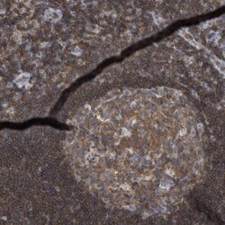 KIAA1731NL Polyclonal Antibody:Antibodies, Polyclonal