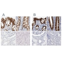 Invitrogen&trade;&nbsp;CDH17 Polyclonal Antibody
