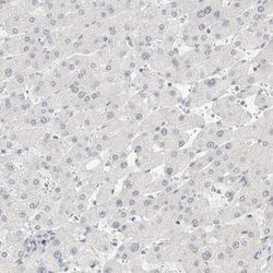 Invitrogen CDH17 Polyclonal Antibody 100 &mu;L; Unconjugated:Antibodies