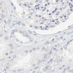 Invitrogen CDH17 Polyclonal Antibody 100 &mu;L; Unconjugated:Antibodies