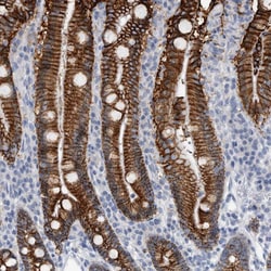 Invitrogen CDH17 Polyclonal Antibody 100 &mu;L; Unconjugated:Antibodies,