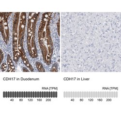 Invitrogen CDH17 Polyclonal Antibody 100 &mu;L; Unconjugated:Antibodies,