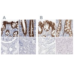 Invitrogen CDH17 Polyclonal Antibody 100 &mu;L; Unconjugated:Antibodies,