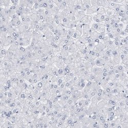 Invitrogen CDH17 Polyclonal Antibody 100 &mu;L; Unconjugated:Antibodies,