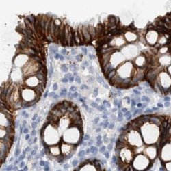 Invitrogen CDH17 Polyclonal Antibody 100 &mu;L; Unconjugated:Antibodies,