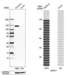 Invitrogen CDH17 Polyclonal Antibody 100 &mu;L; Unconjugated:Antibodies,