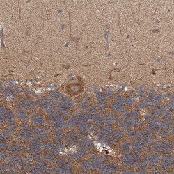 Invitrogen TRIM16 Polyclonal Antibody 100 &mu;L; Unconjugated:Antibodies,
