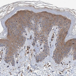 Invitrogen TRIM16 Polyclonal Antibody 100 &mu;L; Unconjugated:Antibodies,
