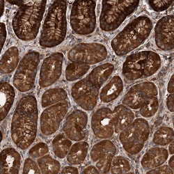 Invitrogen TRIM16 Polyclonal Antibody 100 &mu;L; Unconjugated:Antibodies,