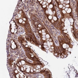Invitrogen ITGB6 Polyclonal Antibody 100 &mu;L; Unconjugated:Antibodies,
