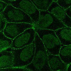 Invitrogen ITGB6 Polyclonal Antibody 100 &mu;L; Unconjugated:Antibodies,