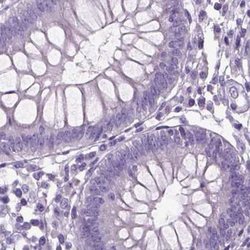 Invitrogen NECAB1 Polyclonal Antibody 100 &mu;L | Buy Online | Invitrogen&trade; | Fisher Scientific