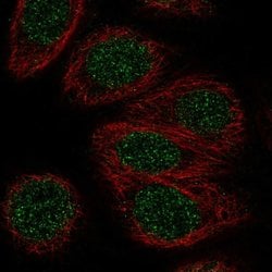 Invitrogen ZNF653 Polyclonal Antibody 100 &mu;L; Unconjugated:Antibodies,