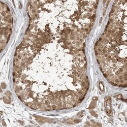 Invitrogen ZNF653 Polyclonal Antibody 100 &mu;L; Unconjugated:Antibodies,