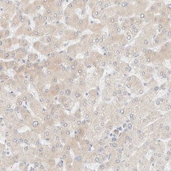 Invitrogen NT5C Polyclonal Antibody 100 &mu;L | Buy Online | Invitrogen&trade; | Fisher Scientific