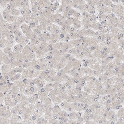 Invitrogen UNK Polyclonal Antibody 100 &mu;L; Unconjugated:Antibodies,