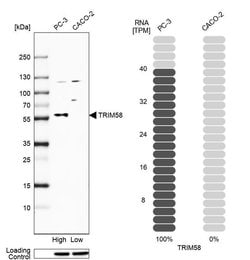 Invitrogen TRIM58 Polyclonal Antibody 100 &mu;L; Unconjugated:Antibodies,