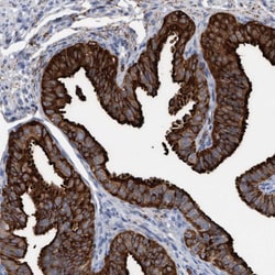 Invitrogen C17orf74 Polyclonal Antibody 100 &mu;L; Unconjugated:Antibodies,