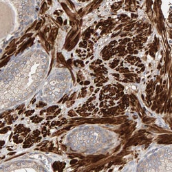 Invitrogen RNF19A Polyclonal Antibody 100 &mu;L; Unconjugated:Antibodies,